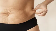 Magen efter 50 försvinner inte av sig själv – så aktiverar du det dolda fettförbränningsläget